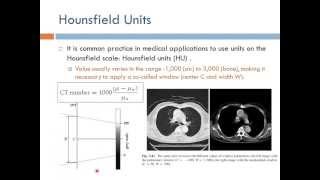 Medical Equipment Computed Tomography Arabic Narration [upl. by Akemal]