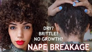 NAPE BREAKAGE  HEALTHY HAIR JOURNEY PT 4 [upl. by Nador]