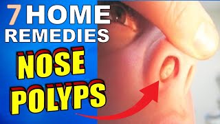 7 Natural Treatments amp Home Remedies For Nasal Polyps [upl. by Yuma]