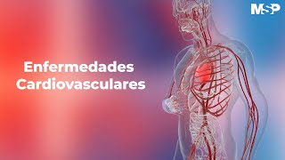 Enfermedades cardiovasculares [upl. by Htebasile192]