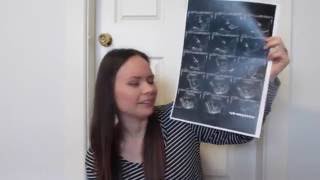 14 Weeks Pregnant  Morning sickness food aversions [upl. by Enyledam]