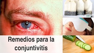 Remedios naturales para la conjuntivitis y consejos para prevenirla [upl. by Elleraj100]