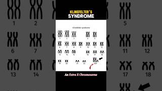 KLINEFELTER SYNDROME klinefeltersyndrome  WHAT IS KLINEFELTER SYNDROME shortsviraltrending [upl. by Akemhs760]