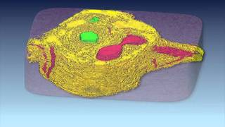 3D Reconstruction of Liver Portal Tracts From a Normal and Abnormal Dog [upl. by Naitsirk8]