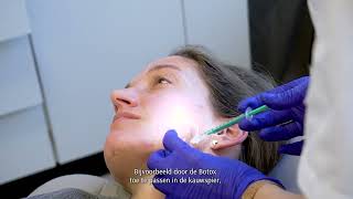 TREATMENT Confidence Booster® COLLAGEN amp Botox behandeling [upl. by Eidnim]