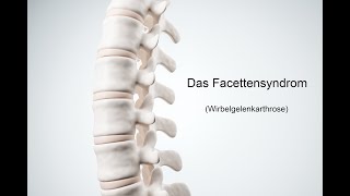 Facettensyndrom 2 Übungen gegen Rückenschmerzen [upl. by Haldas]