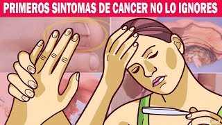 Primeros Síntomas y Signos de Cáncer que no debemos ignorar ¡Mucho Cuidado [upl. by Terchie754]