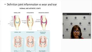 Diagnosing and managing psoriatic arthritis [upl. by Minoru]