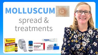 Molluscum FAQ about the spread and treatment from a pediatric dermatologist in 2022 [upl. by Lou558]