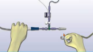 Intra Abdominal Pressure [upl. by Akirdnas]