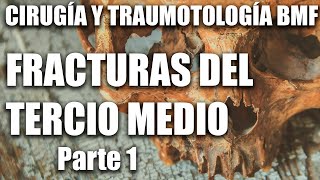 Cirugía y Traumatología Fracturas del Tercio Medio parte 1 [upl. by Yesnik]