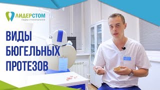 Виды бюгельных протезов 😬 Бюгельное протезирование в стоматологии Лидерстом [upl. by Nnylahs672]