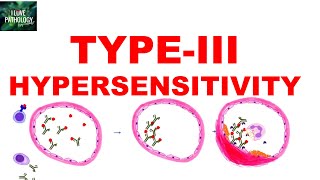 Type III Hypersensitivity  Immune complex mediated Hypersensitivity  Mechanism  Examples [upl. by Ayikin382]