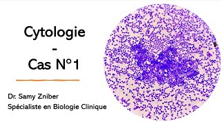 🔬Cytologie  Anomalies Morphologiques dans le Frottis Sanguin et le Myélogramme 🔬 [upl. by Rawdin452]