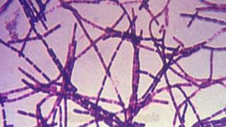 Anthrax and Bacillus anthracis [upl. by Pascal]