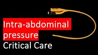 HOW and WHY do we measure intra abdominal pressure [upl. by Norrahc]