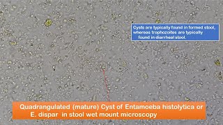 Entamoeba histolytica in Stool Microscopy at 400X and 800X [upl. by Trebuh]