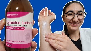 How to apply Calamine lotion on chicken pox  How to apply calamine lotion on face [upl. by Etteraj]