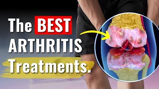 Knee Arthritis Treatments Proven to Work  The Truth You Need to Know [upl. by Adriene]