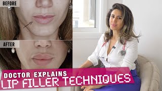 Which Lip Filler Technique 5 Case Studies for BEST RESULTS  Doctor Explains 💋💉 [upl. by Eleanore]