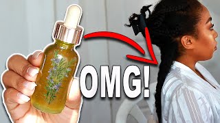 THE ULTIMATE ROSEMARY OIL FOR EXTREME HAIR GROWTH YOUR HAIR WILL NEVER STOP GROWING [upl. by Jorge]