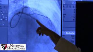 Coronary Stents  The Nebraska Medical Center [upl. by Jair]