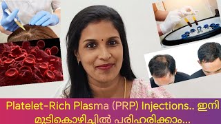 മുടികൊഴിച്ചിൽ പരിഹരിക്കാംPRP Treatment Indetail [upl. by Cormier]