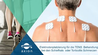 Torticollis oder Schiefhals  Elektrodenplatzierung für TENS  axion [upl. by Aissak]