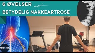 6 Øvelser mot Betydelig Nakkeartrose [upl. by Bruis]