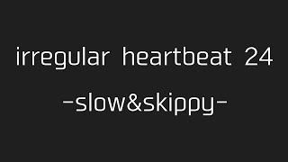 徐脈amp期外収縮3連発（irregular heartbeat 24  slowampskippy） [upl. by Anileme]