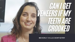 CAN I GET PORCELAIN VENEERS IF MY TEETH ARE VERY CROOKED  Beverly Hills Dentistry [upl. by Laval]