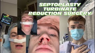 Septoplasty Turbinate Reduction Surgery Recovery vlog  tips ￼ [upl. by Haropizt]