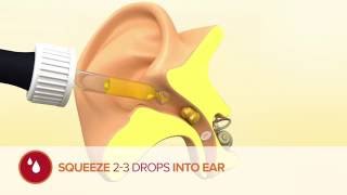 How to use Otex Olive Oil Ear Drops [upl. by Priestley]