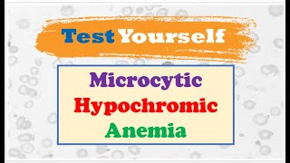 Diffrential Diagnosis 🔷 of Microcytic Hypochromic Anemia [upl. by Phelips]