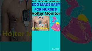 What is Holter Monitoringecgnurseaiims youtubeshorts [upl. by Bala]