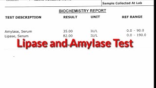 Lipase and Amylase test pancreatitis Pathology pathology bloodisorder [upl. by Des698]