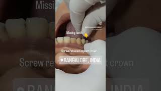 Jai Hind 🇮🇳 Missing tooth replaced with a dental implant and a screw retained crown [upl. by Releehw]