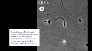 Variations of sperm swimming [upl. by Siol]