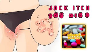 ඉකිලි කැසීම​ට බෙහෙත්  Jock Icth [upl. by Molton]