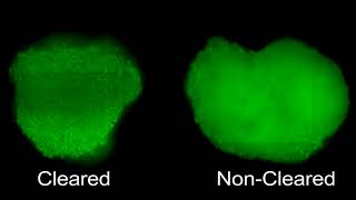 Tissue Clearing of HepG2 Spheroids for HCS [upl. by Jezabelle]