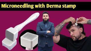 microneedling derma stamp derma roller hair regrowth  hair loss treatment  how to use derma Roler [upl. by Neliac]