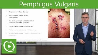 Pemphigus Vulgaris – Dermatology  Lecturio [upl. by Lledniw]