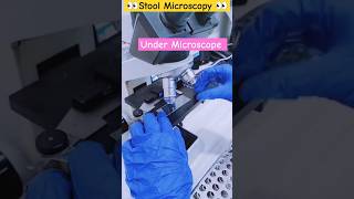 Stool Examination Stool Analysis Test shortsvideo stool medical dmlt bmlt shorts [upl. by Nitsraek]