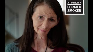 CDC Tips From Former Smokers  Christine B Oral Cancer Effects [upl. by Halbeib]