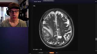 How to use Radiopaedia to teach [upl. by Cormier]