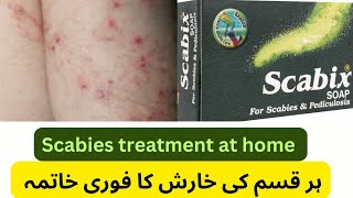 Scabix soap uses in Urdu scabies treatment at home scabix soap  pediculosis [upl. by Leahkim]