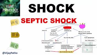 SHOCK Types Pathogenesis of Septic Shock [upl. by Egroej519]