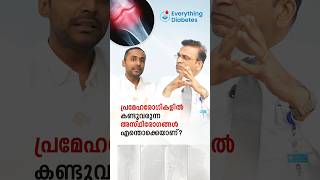 പ്രമേഹരോഗികളിൽ കണ്ടുവരുന്ന അസ്ഥിരോഗങ്ങൾ എന്തൊക്കെയാണ് [upl. by Anivahs855]