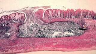 Entamoeba histolytica [upl. by Neely]