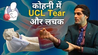 कोहनी में लिगामेंट इंजरी और लचक  Elbow Ulnar Collateral Ligament UCL Tear Treatment [upl. by Richers661]